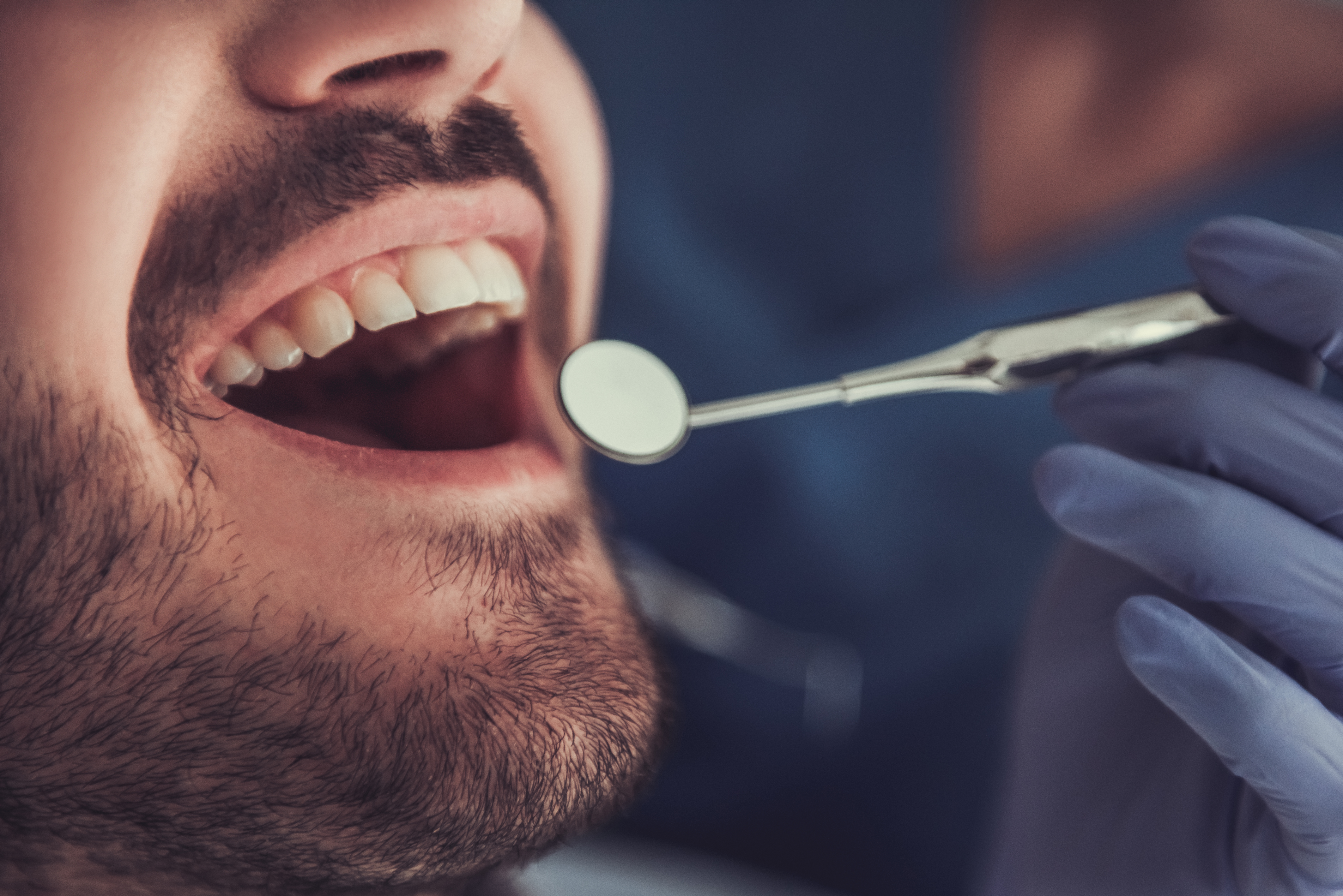 Leczenie próchnicy u dorosłych, leczenie stomatologiczne, zabieg u dentysty
