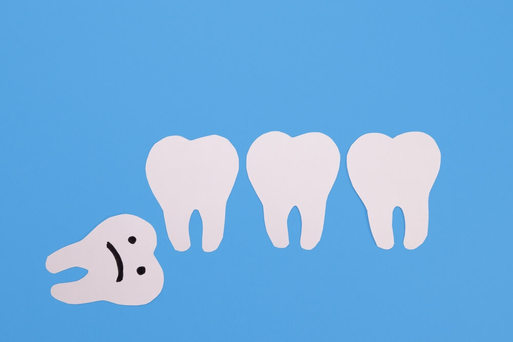 usuwanie zęba zatrzymanego