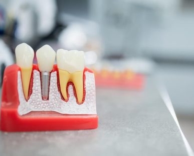 wszczepienie implantu
